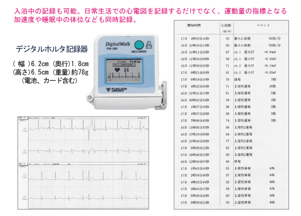 ホルター心電図